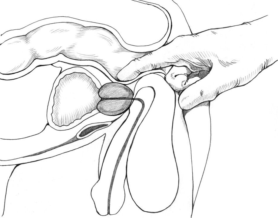 Prostate massage is part of the complex of prostatitis treatment methods